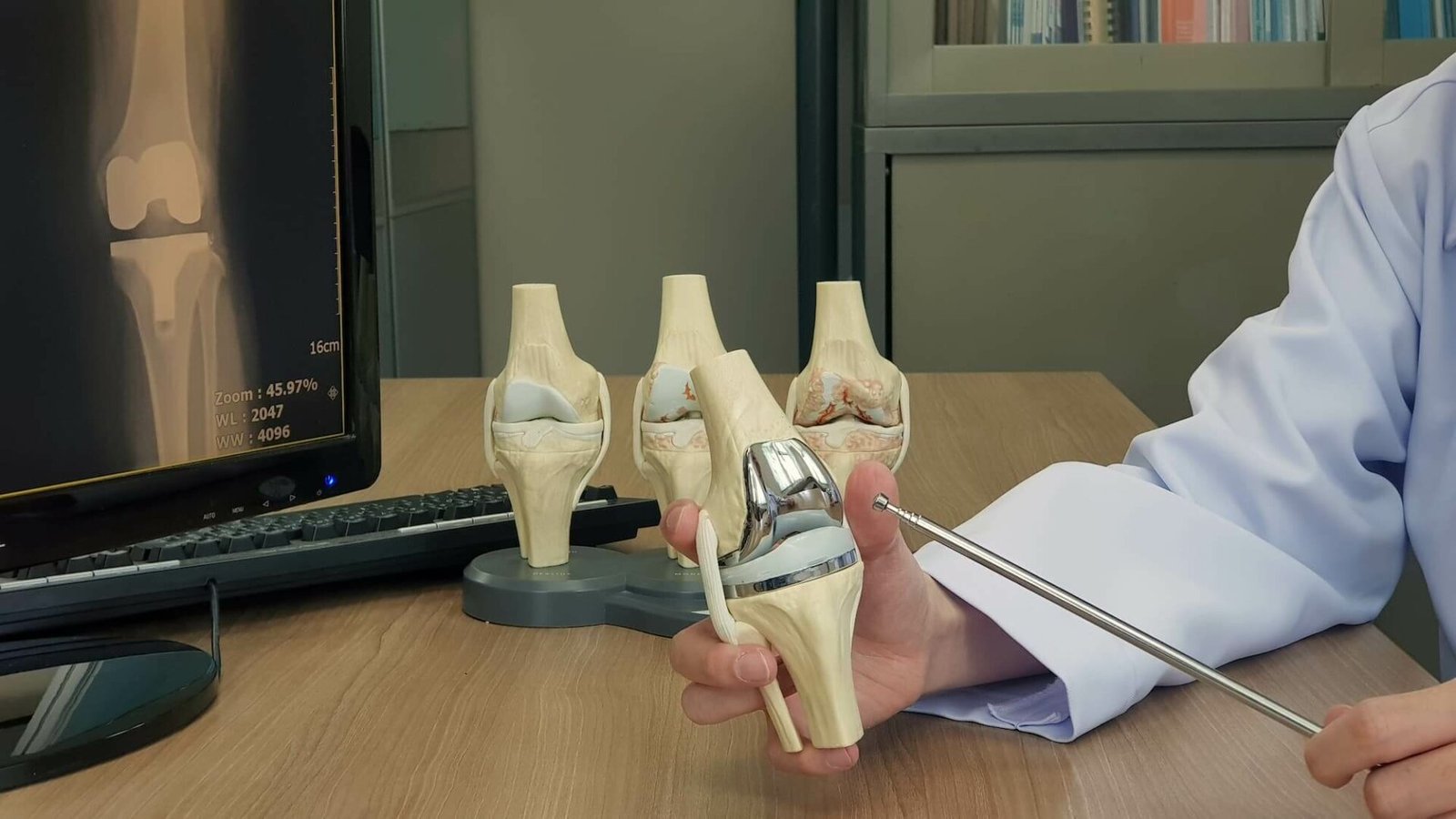 Geleneksel Yöntemlere Karşı Robotik Diz Protezi Hangisi Daha İyi?