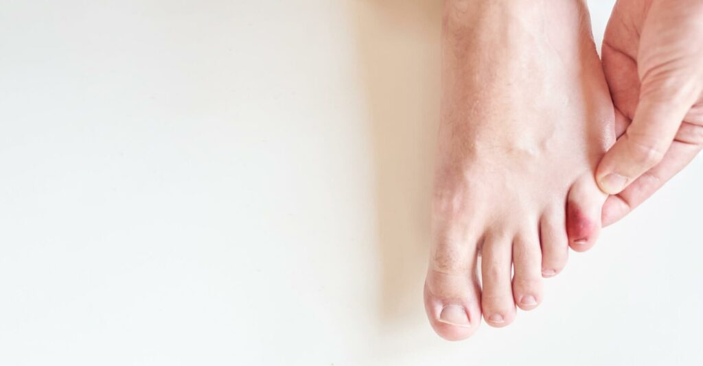 Terzi Bunyonu (Bunyonet)